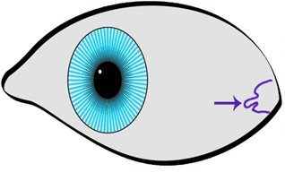 Iridology sign illustration